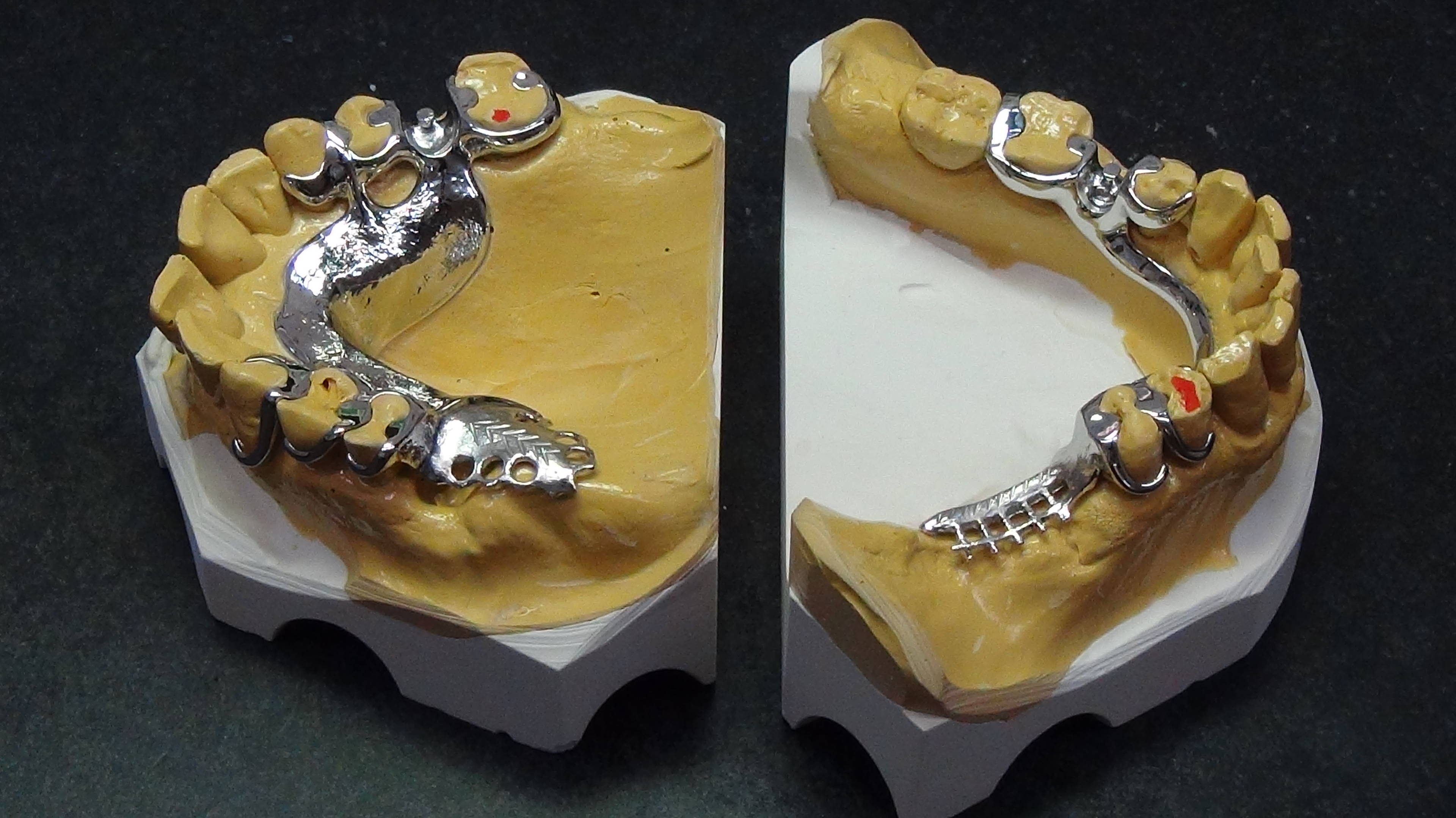 OK und UK Modelle mit fertigen Gerüsten