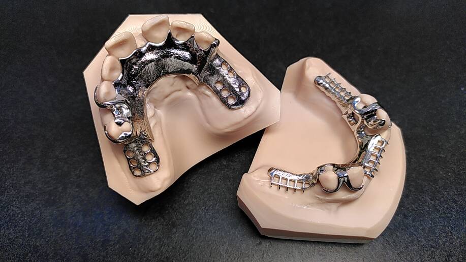 OK und UK Modelle mit fertigen Modellgussgerüsten